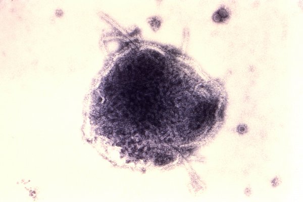 [Alta de casos de sarampo faz Opas convocar países para reforçar vacinação]
